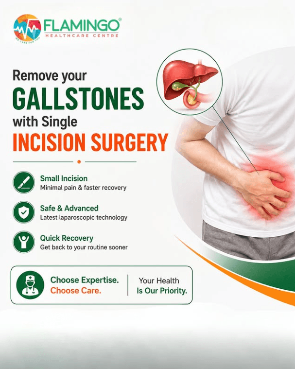 Remove Your Gallstones With Single Incision Surgery featured image
